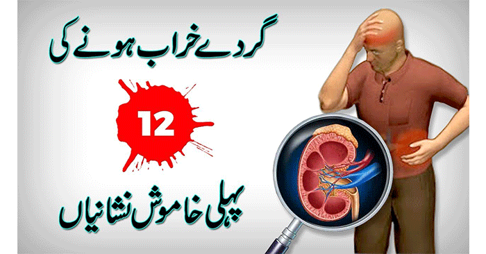 Kidney-Failure