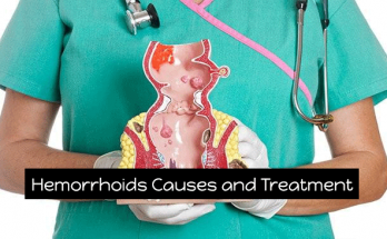 What-is-Hemorrhoids--Symptoms-and-Treatment