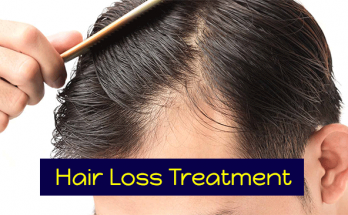 HAIR-LOSS-treatment