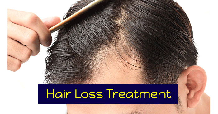 HAIR-LOSS-treatment