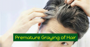 Premature Graying Of Hair Causes, Symptoms And Treatment Options
