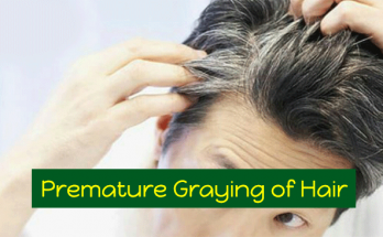 Premature-Graying-of-Hair-Causes,-Symptoms-and-Treatment-Options