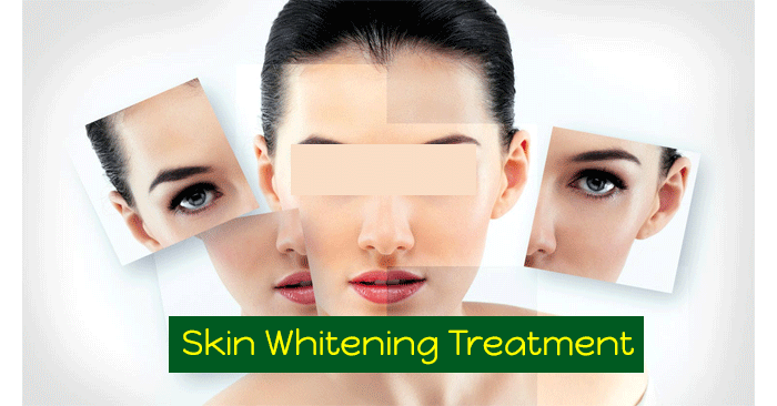 Skin Whitening Treatment