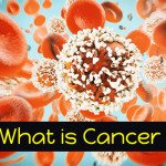 What is Cancer? Types, Stages, Early Warning Signs & Symptoms and Treatment