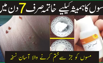 Skin Tag Removal Cream in Pakistan