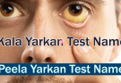 Yarkan in English Kala Yarkan Peela Yarkan Test Name and Price in Pakistan